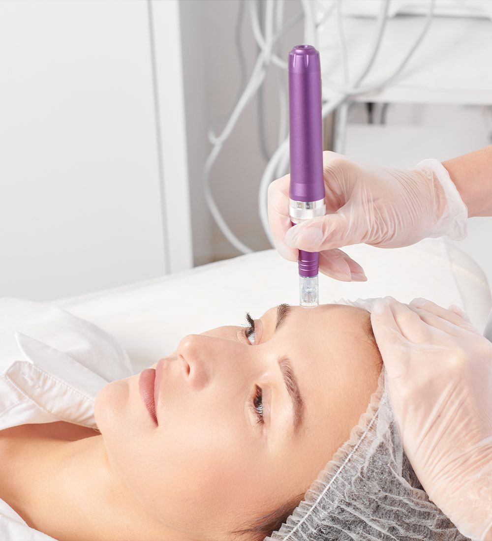 Fractionated radiofrequency needling (MNRF) C