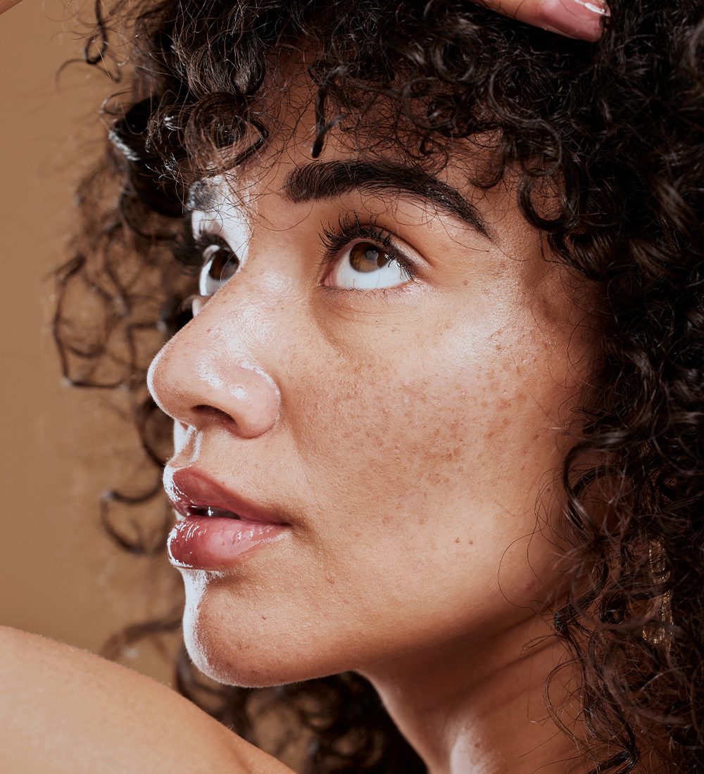 Freckles Treatment c