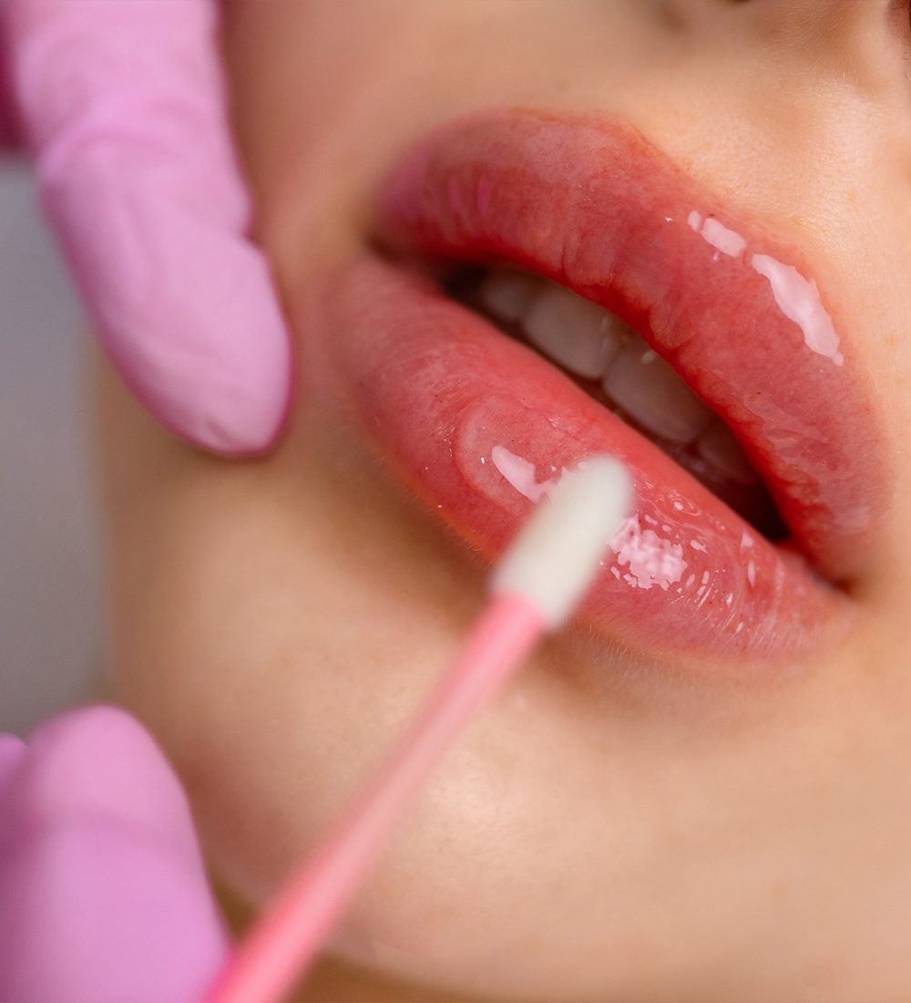 Lip reduction C