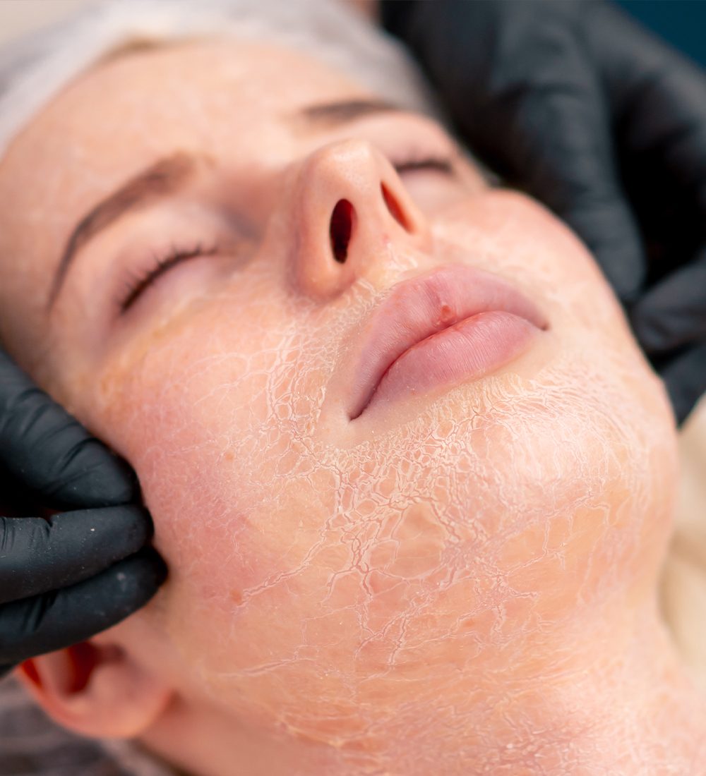 Open Pores c