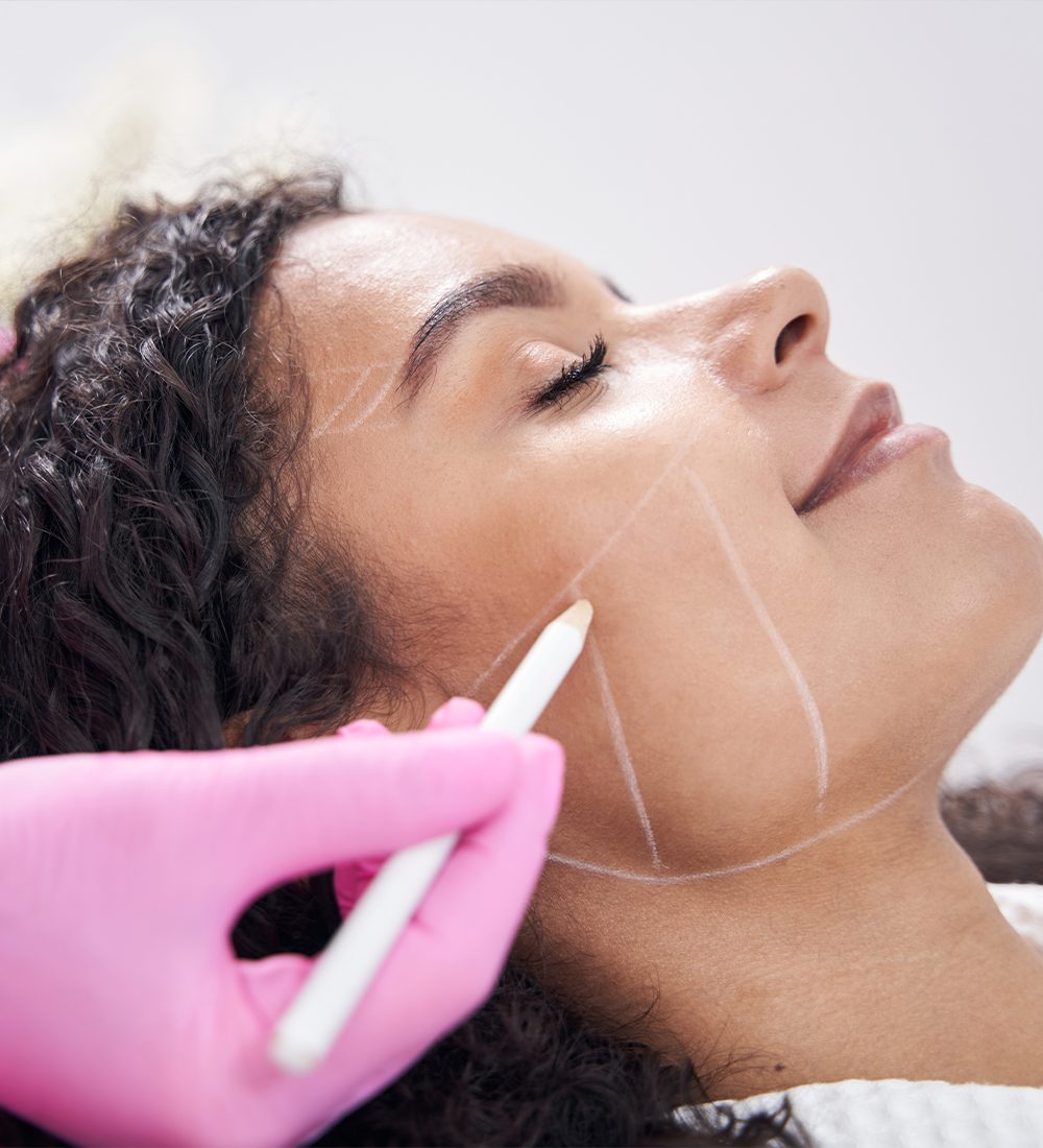 Thread Lift (Full Face - Jawline, Cheeks, Neck, Eyebrows) C