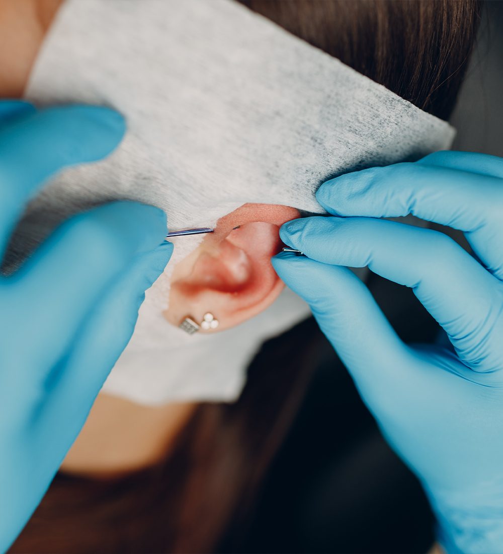 earlobe repair surgery C