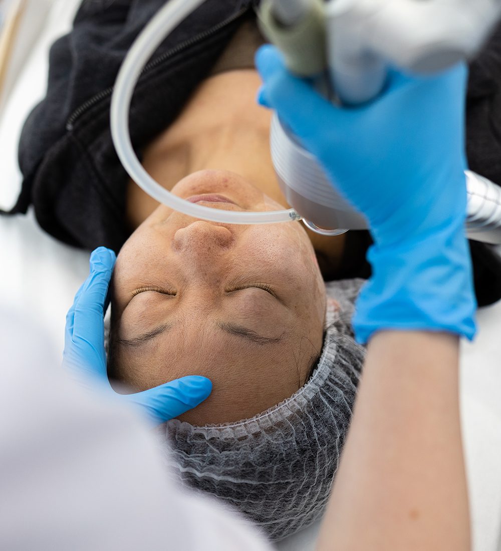 hydra photo facial C