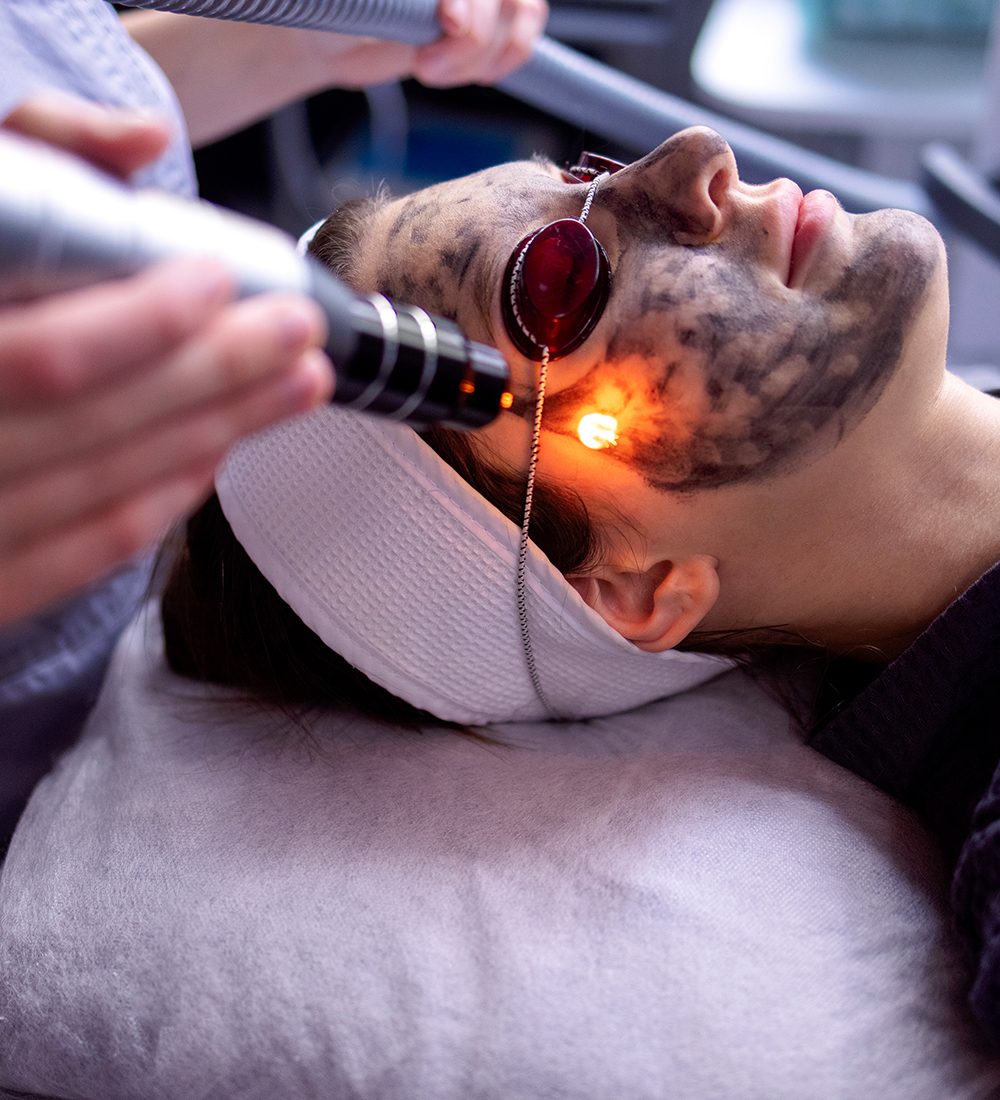 intense pulsed light (IPL) C